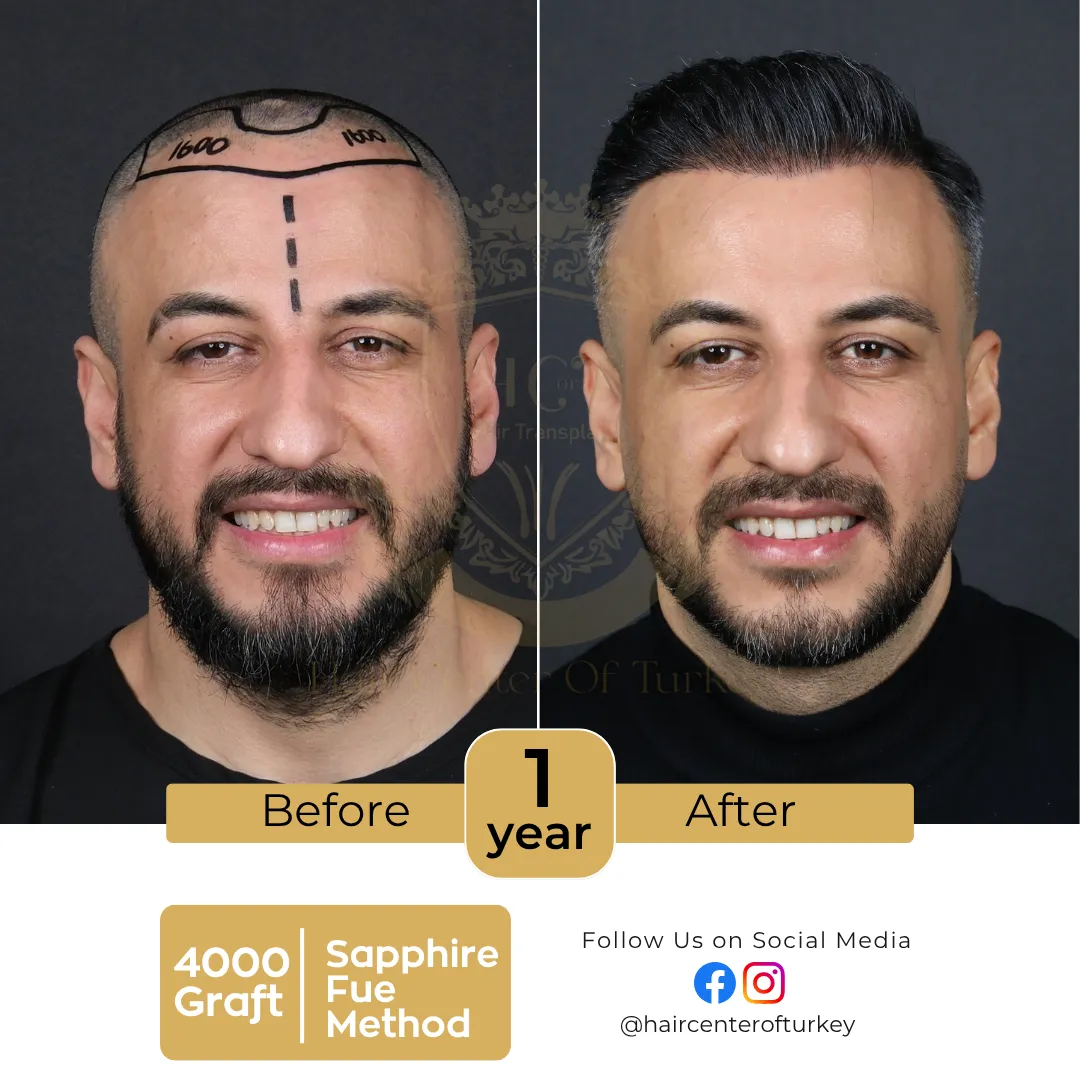 Documented result